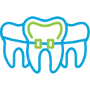 Braces
